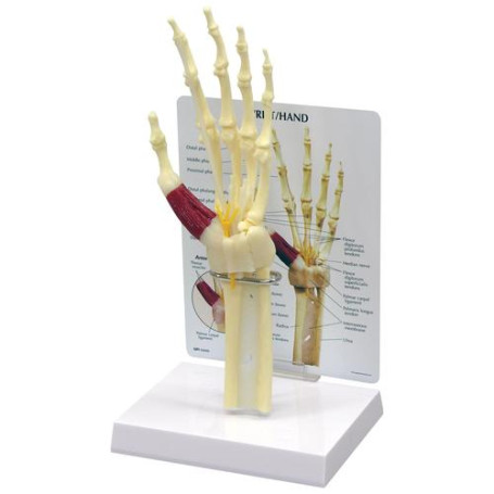 GPI Anatomicals carpal tunnel syndrome hand model